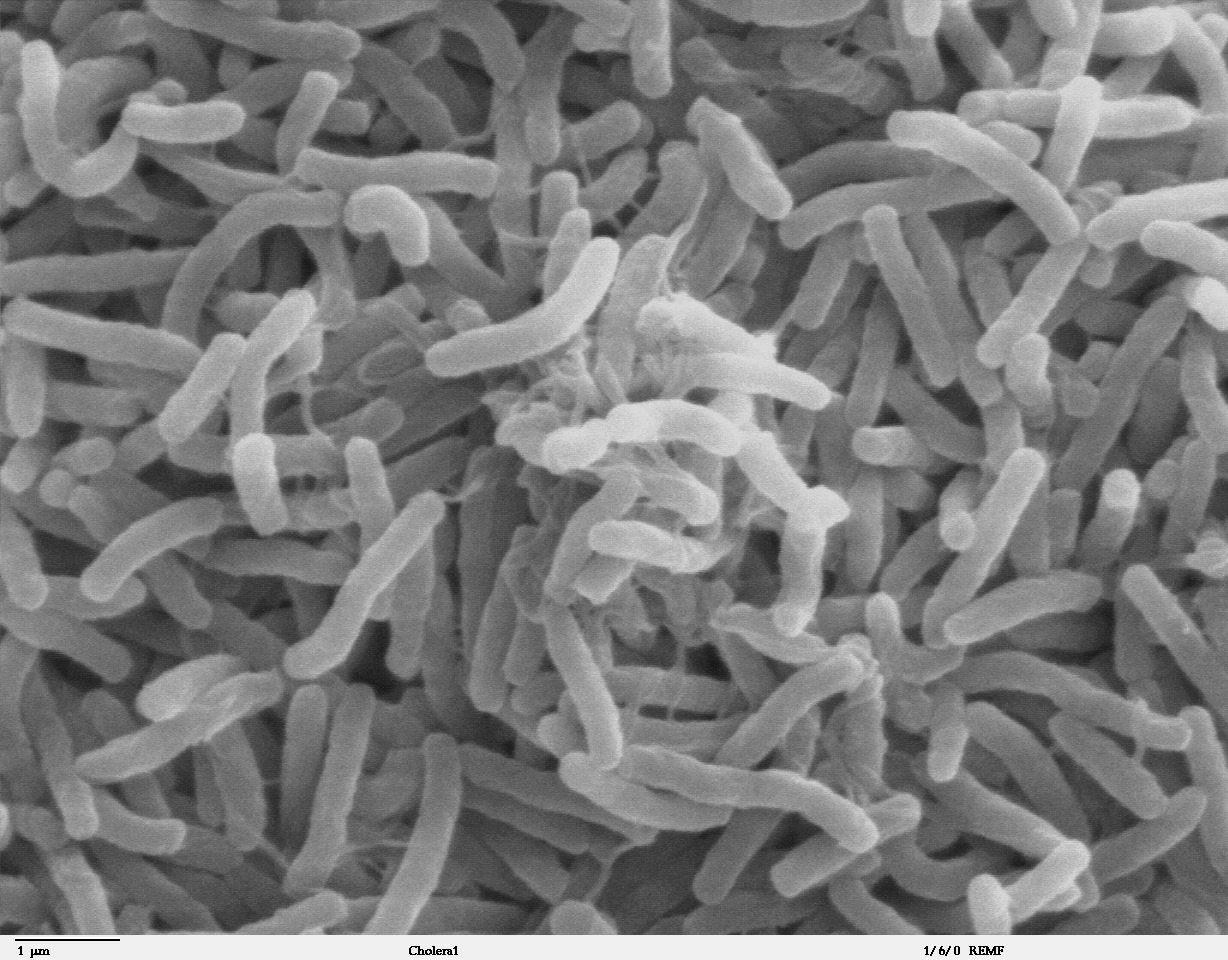 https://medqaz.com/wp-content/uploads/2020/11/Cholera_bacteria_SEM.jpg