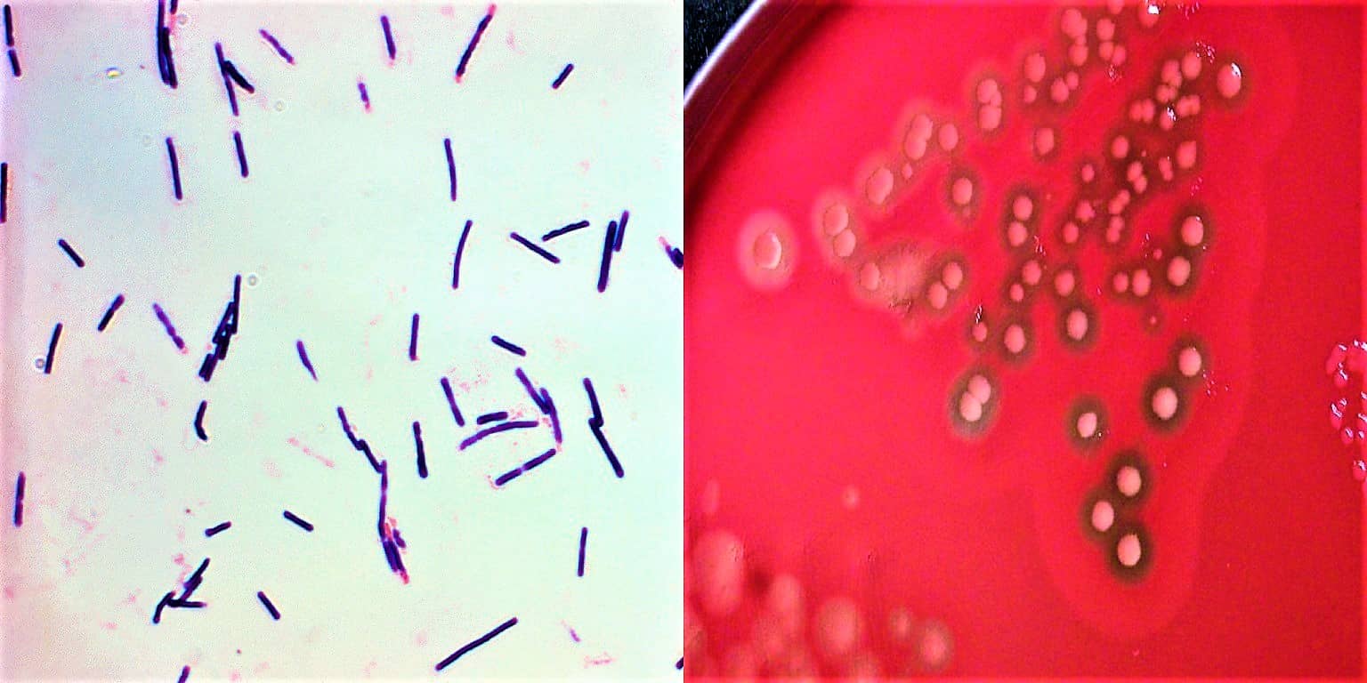 Тамақтан улану: Clostridium perfringens