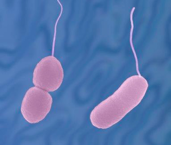 Vibrio parahaemolyticus дегеніміз не