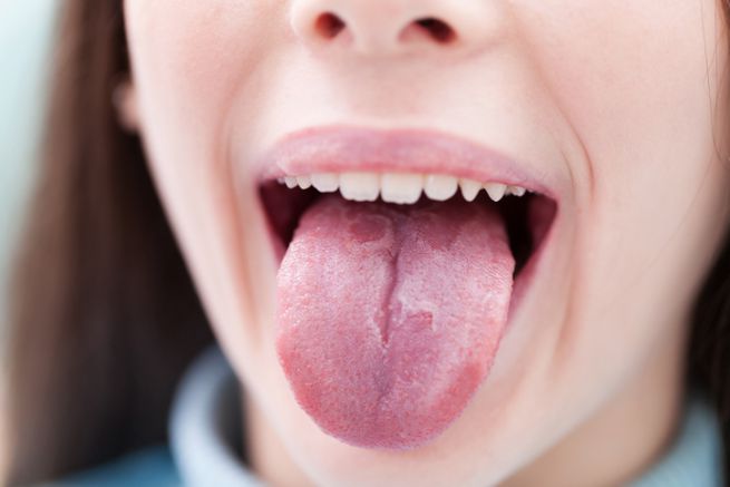 https://medqaz.com/wp-content/uploads/2020/12/mouth.jpg