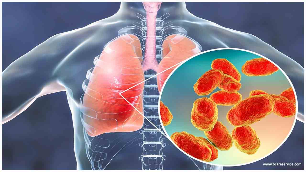 Бактериялық пневмония: белгілері және емі