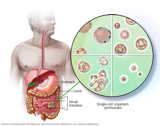 Blastocystis hominis - себептері, белгілері және емі